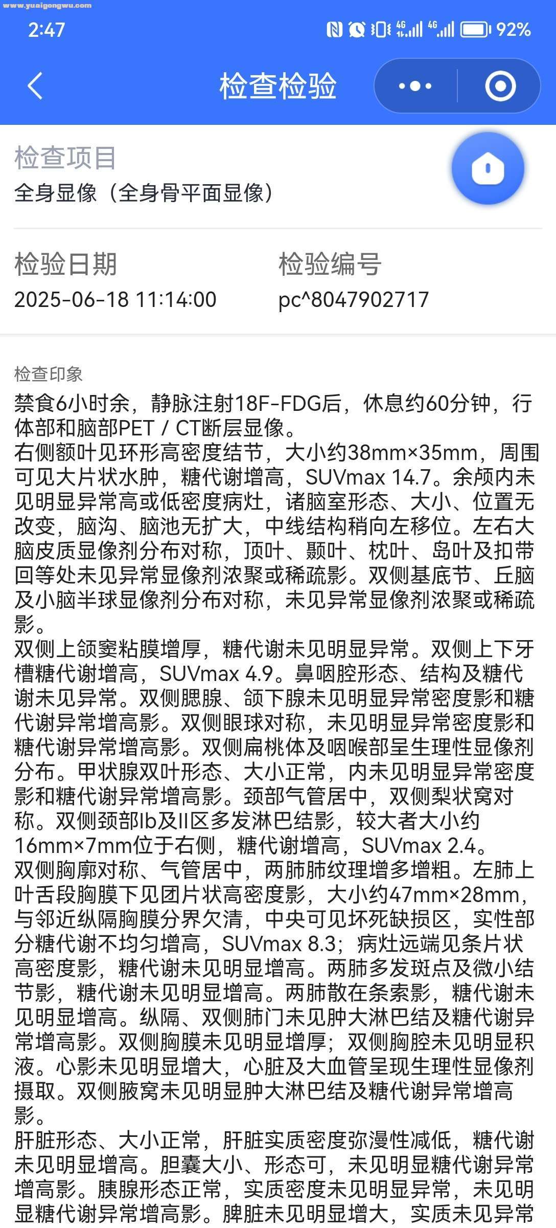 父亲肺鳞癌，cT3N0M1a，ⅣA，脑转移，每天害怕，请求在心理和治疗方面的帮助